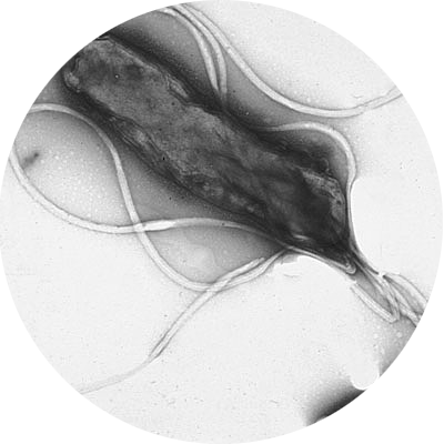 Helicobacter pylori – Ein unterschätzter Magenkeim